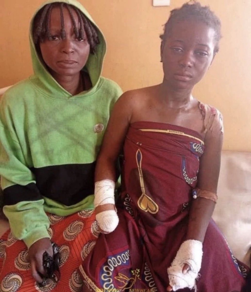 viviapostat's tweet photo. Un djihadiste musulman coupe les mains d’une chrétienne qui refuse le mariage et l’esclavage sexuel. Elle s’enfuit avant la décapitation.

Plus de chrétiens tués au Nigeria l’an dernier qu’à Gaza.

Silence total des médias. https://t.co/aCsl1Il9vV