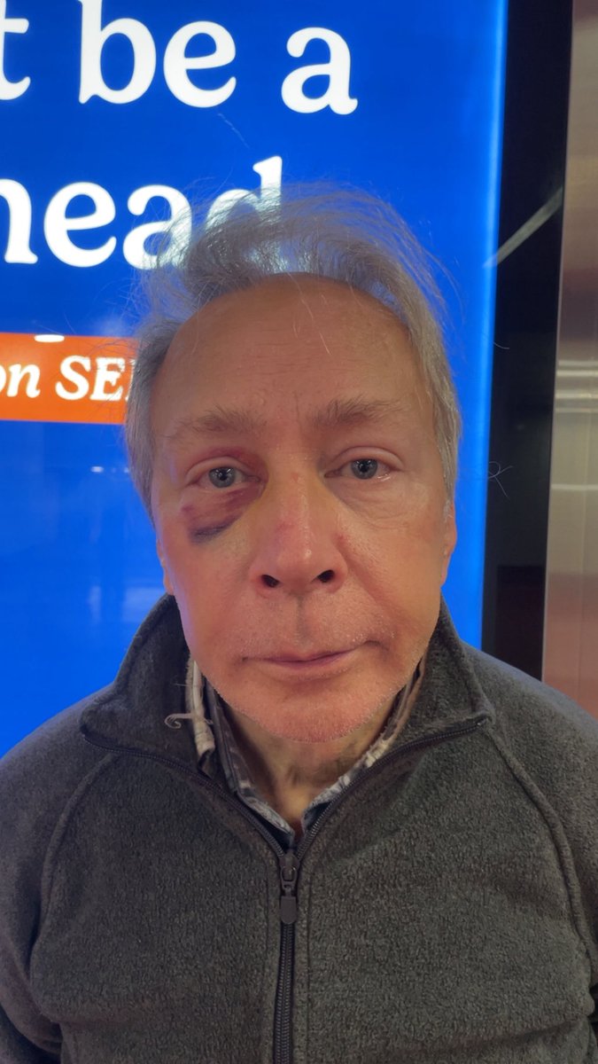 Bkingstevek's tweet photo. I was assaulted. @PhillyPolice #Votephilly https://t.co/Rv8NRSxQed