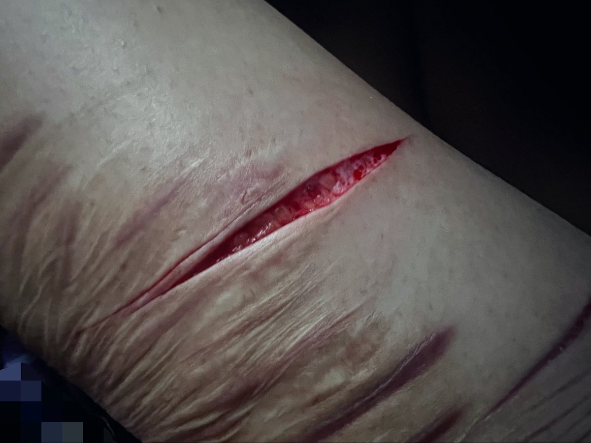 _J0324's tweet photo. more fake sfx makeup practice https://t.co/IxDl1X080A