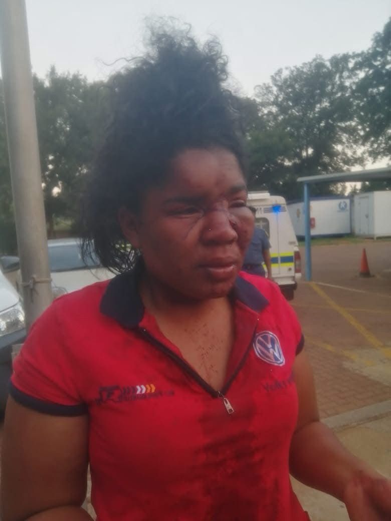 IanCameron23's tweet photo. Camillia Beyers survived something no woman should ever have to experience.

Her former boyfriend, an Ekurhuleni Metro Police officer, kidnapped her and severely assaulted her after their relationship ended. He beat her while driving, used his firearm during the ordeal and fired shots close to her.

What made this case even more frustrating was that the man she was trying to escape was himself a law-enforcement officer.

I became involved because the case was not being dealt with with the urgency it deserved. We pushed for proper investigation and accountability while Camillia had to obtain a protection order simply to try to keep herself safe.

Even after being released on bail, he continued harassing and intimidating her. He was eventually rearrested for violating the protection order, dismissed from the EMPD and ultimately convicted.

He was sentenced to an effective five years’ imprisonment and declared unfit to possess a firearm.

Camillia survived.

But women should not have to fight an abuser and then fight the system responsible for protecting them.

When a perpetrator wears a uniform, accountability has to be stronger, not weaker.

IC