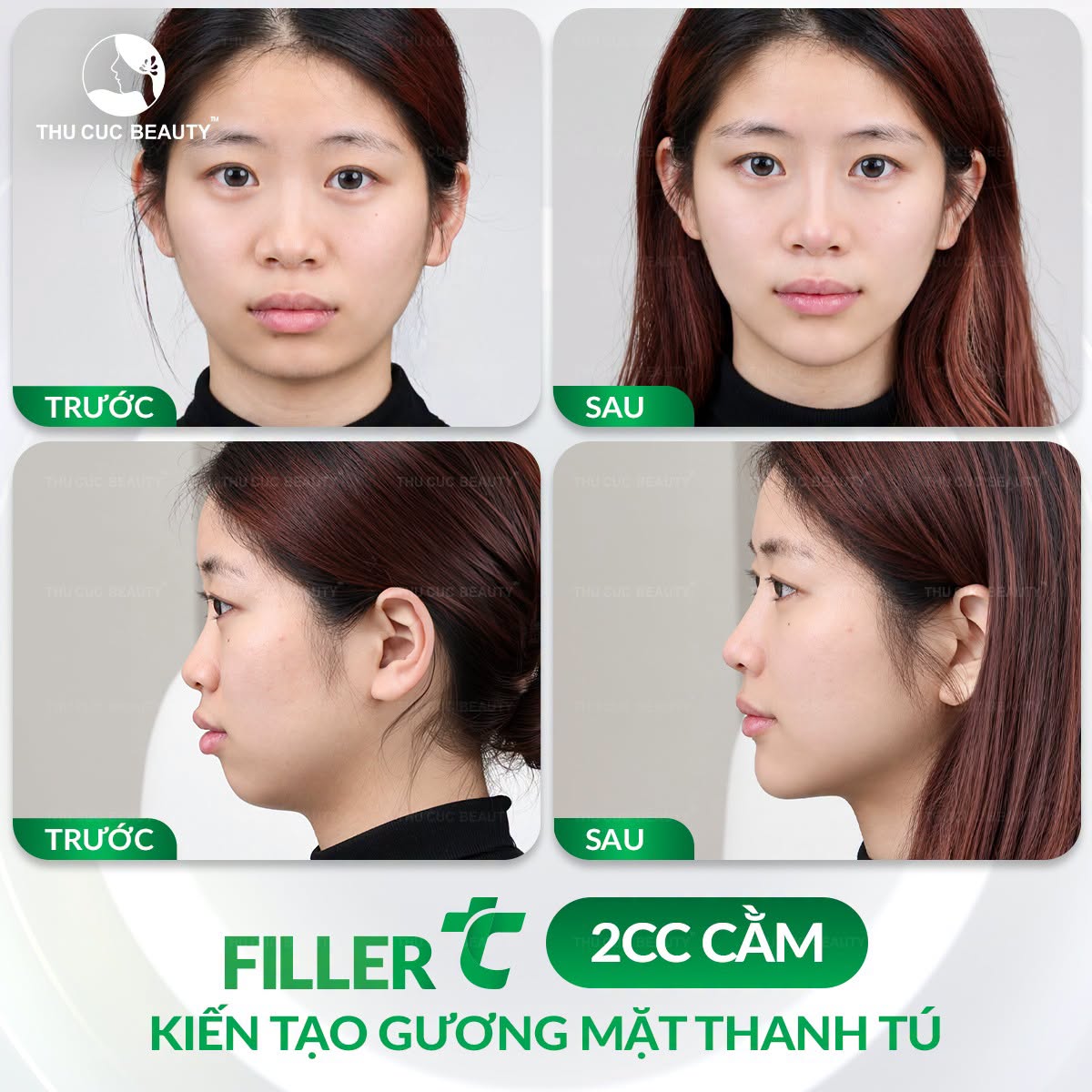 thammythucuc1's tweet photo. Những điều cần biết khi tiêm filler cằm
Cùng tìm hiểu ngay:
https://t.co/RNtxbQmSlK
---
Mọi thông tin liên hệ
Tổng đài: 1900 1920 – Hotline: 0964 080 999
Địa chỉ: 1B Yết Kiêu, Hoàn Kiem, Hà Nội.
#thammythucuc #tiemfiller #lamdep https://t.co/29jy2Mb5sK