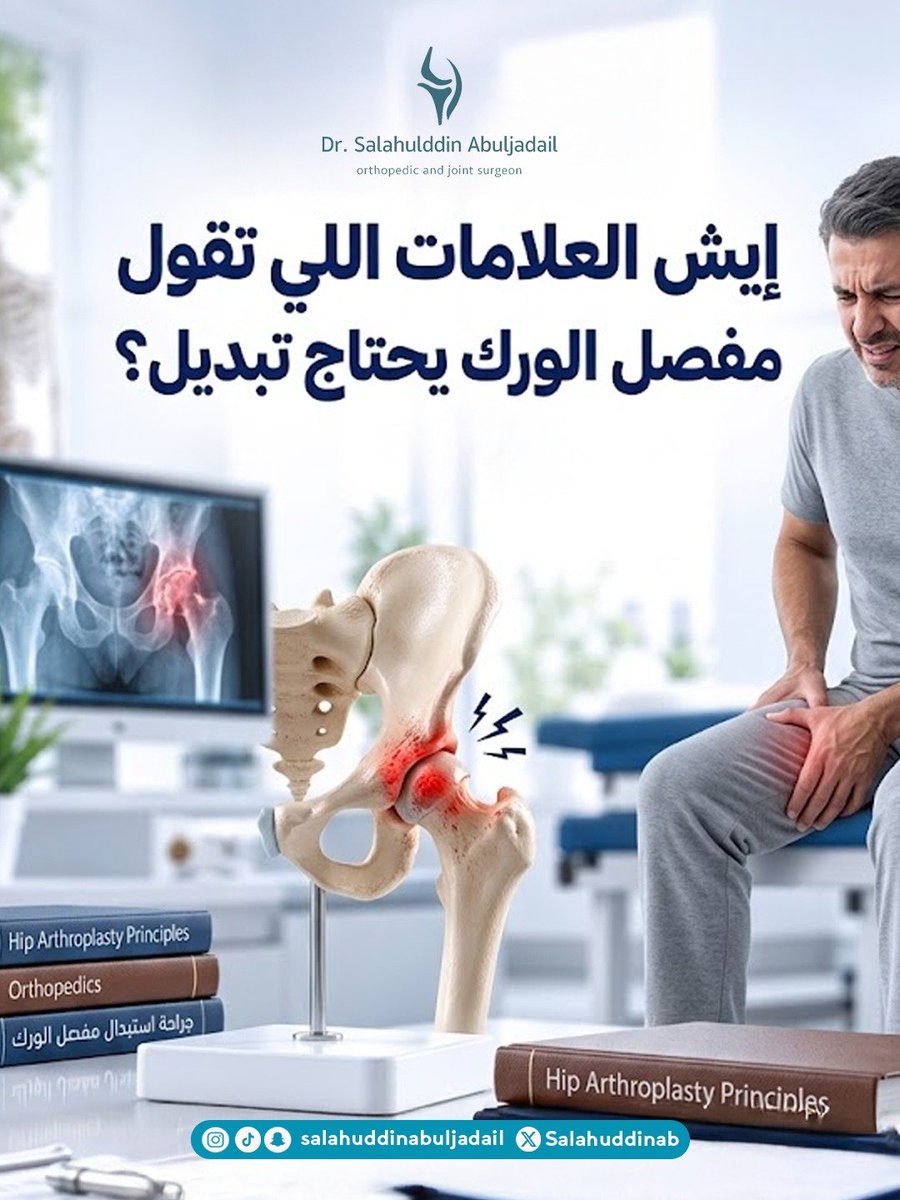 SalahuddinAb's tweet photo. 🔹 ألم مستمر في الورك أو منطقة أعلى الفخذ، خصوصاً مع الحركة
🔹 صعوبة المشي أو الوقوف لفترات طويلة
🔹 تيبّس المفصل وصعوبة لبس الحذاء أو صعود الدرج
🔹 تأثير الألم على النوم والأنشطة اليومية
🔹 عدم تحسن الأعراض بشكل كافٍ مع العلاجات غير الجراحية https://t.co/qdunBR5Xxp