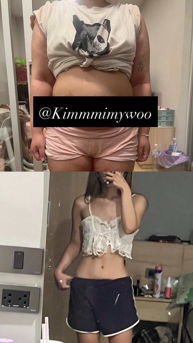 Kimmmimywoo's tweet photo. จากใจคนเป็น Binge Eating มาก่อน จาก น้ำหนัก 43 ไป 69 ตอนนี้ลดมา เกือบ 20 กิโล โดยการ “คุมอาหาร + ออกกำลังกาย”

- เราเลือกไปหาหมอก่อน อันดับแรก เพราะมีภาวะซึมเศร้าพ่วงมาด้วย เลยได้ทานยา 2 เดือน (เลยหายจากการเป็น Binge) แต่น้ำหนักไม่ลดนะคะ เลยกลับมาคุมอาหารอีกครั้งเพื่อลดไขมัน

- เราเลือกทานอาหารที่มีประโยชน์ และมาจากธรรมชาติ ไม่แปรรูป น้ำตาลน้อย ทานโปรตีน ไขมัน คาร์บ ครบใน 1 มื้อ (ไม่ได้ทาน 1 วัน 1 มื้อนะคะ ทานปกติ 3 มื้อ ออกกำลังกาย 4 มื้อ) ทำให้ไม่หิวจุกจิกระหว่างวัน 

- การดื่มน้ำ ดื่มน้ำเยอะๆ 1-2 ขวด (ขวดลิตร) 

- การนอนสำคัญมากค่ะ นอนให้ครบ 7-9 ชม. ต่อวัน

- ออกกำลังกาย เน้น เวท + คาร์ดิโอ เพื่อสร้างกล้ามเนื้อ