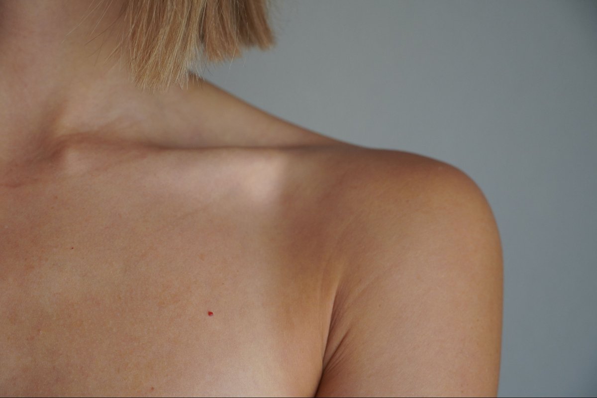 Elmedicoint's tweet photo. INVESTIGACIÓN I Los #inhibidores de IL-17 🛡️ no elevan el riesgo de #enfermedad inflamatoria intestinal en #hidradenitis ✅
Metanálisis publicado en JAMA Dermatology 📌
-
[Un contenido de EMI a través de Univadis] ⬇️
https://t.co/TwAhQLuSI9 https://t.co/bTKp9m4pno
