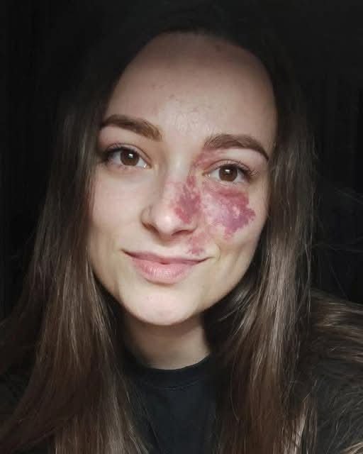 ShireenArtist's tweet photo. Today’s my Birthday! 🎈🎁
But my tweets get ignored like I don’t exist 😭 Maybe it's because I'm ugly face?😭🥺
Please say hi, follow me &amp; make me feel seen! 💖😭 https://t.co/lss75e33NE