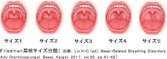 MAYAHFF7R1's tweet photo. 私の扁桃腺、たぶんサイズ3と4の間になっちゃってる
ホント声がガスガスでヤバい😭 https://t.co/C9gkR8UEB6