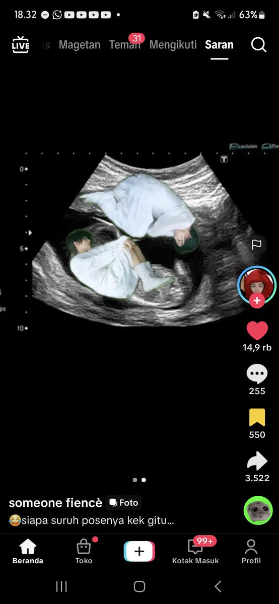 thoughtsofzra's tweet photo. Nemu ginian di tiktok😭
Definisi joshua jeonghan anak kembar dari 1 rahim ibu😭😭
#joshua #jeonghan
#JxJ #정한X조슈아
#DREAMSCAPE https://t.co/cJJlfDDI1A