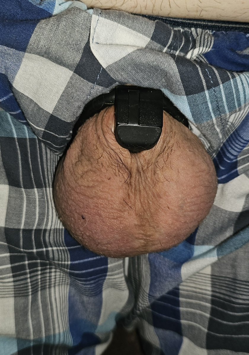 OwnedLockedFag's tweet photo. 2 yr 4 mo 16 days 🍤 🔐
1 yr 9 mo 28 days 🚫💦
PERMANENT per @MasterFagFeeder
🚫 erections
🚫 form of masturbation
🚫 ejaculation
🚫 see the light of day
#blackowned #lockedforlife #gaychastity #reducedtonothing #dicklessfag #fag #owned https://t.co/jnFR2BXfL9