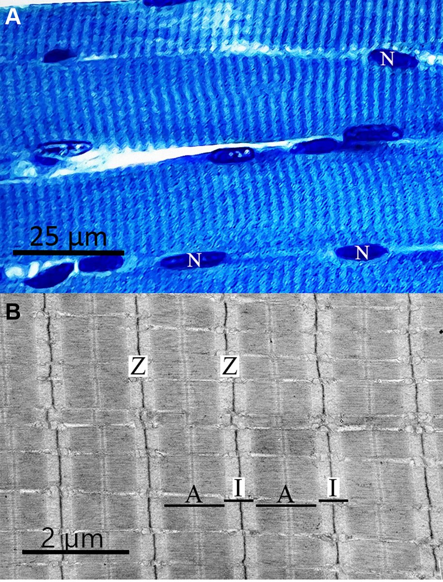 AdvPhysiolEduc's tweet photo. 🔓Open access: Historical Perspectives
“Why are some muscles striated? A structural mechanism that amplifies shortening velocity”
Scott Medler
🖱️ https://t.co/Aa3rhB9QJf
#StriatedMuscle #SkeletalMuscle https://t.co/0ko7fpFGFM