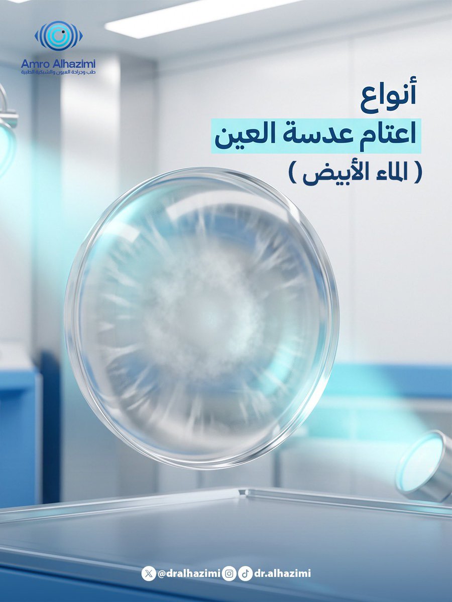 DrAlhazimi's tweet photo. اعتام عدسة العين ( الماء الأبيض) ليس نوعًا واحدًا! 

يحدث اعتام عدسة العين عندما تفقد العدسة الطبيعية شفافيتها، وقد يظهر بأشكال مختلفة حسب مكان العتامة وسببها. https://t.co/nyjEJ3Q3jL