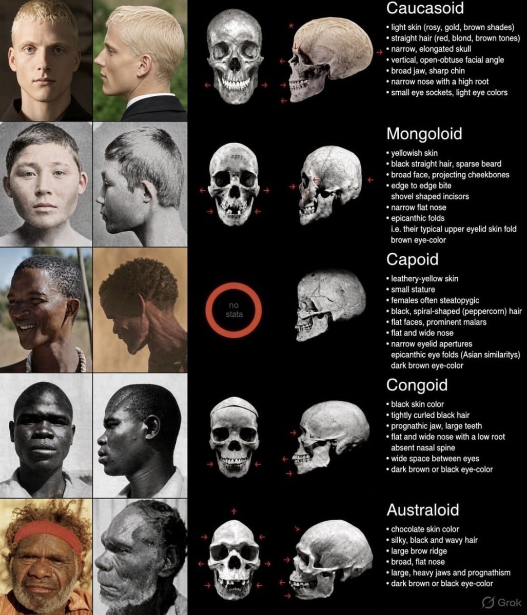 Richard66110384's tweet photo. According to Christian’s, we all came about from genesis &amp; are all brothers &amp; sisters.

All it takes is to examine these features, &amp; evolution. 

You really think this is consistent with genesis? https://t.co/EH6XWAQEML