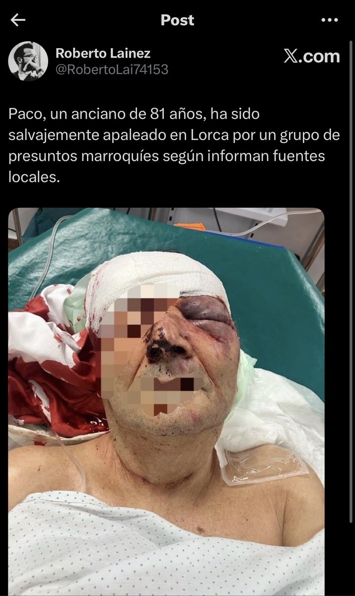 Edcv6yk5's tweet photo. @martagg82 A eso jamás. 
A. C.  o Vox. 

No hay más. 
Esto e año que vitas. 

También fuiste a Teruel?????

SOLO PREGUNTO https://t.co/gG3yeMHX27