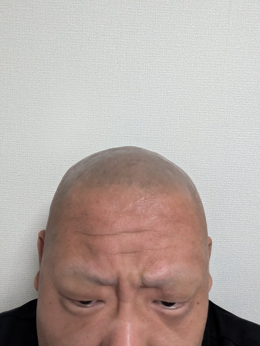 Truthhypocrites's tweet photo. 髪剃ったを♥ https://t.co/udHf3IYqiB
