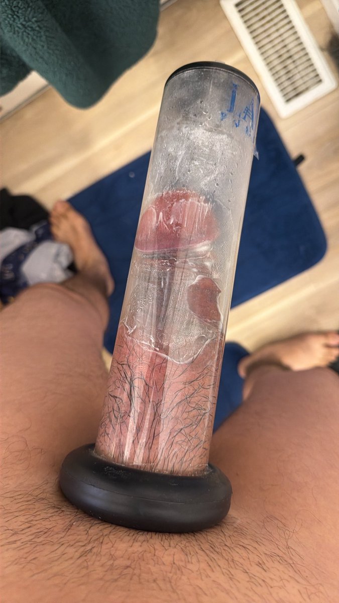 daddybuu13's tweet photo. Day 7 #penispump #gains #PE https://t.co/JAN69Zz6XW