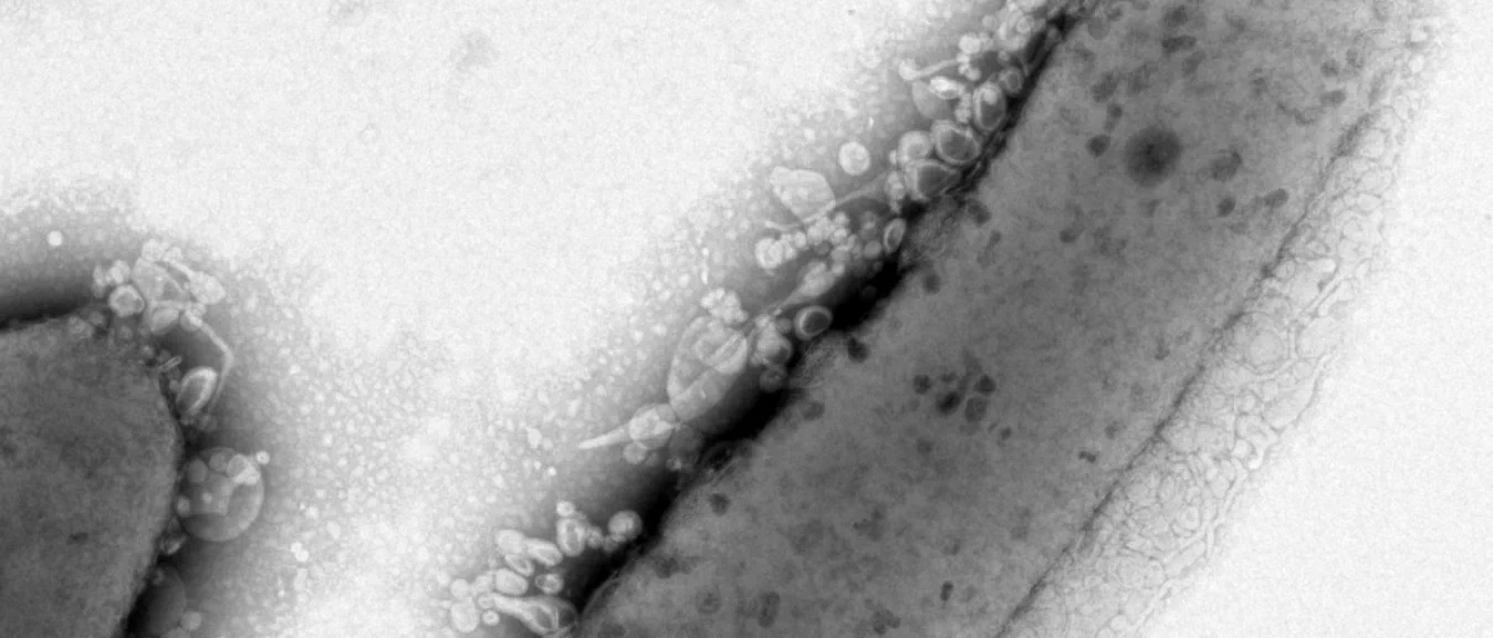 This microscope image of a bacterial cell shows lipid droplets on the exterior of the cell wall. The cell envelope that has been modified to increase lipid production.
