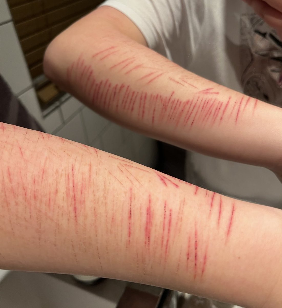 frostbit3s's tweet photo. I miss these pretty cat scratches from last winter ��� https://t.co/7Hzjtm8B1C