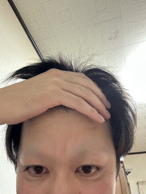 SG__85's tweet photo. 眉毛全剃りした時のやつ　懐かしいww www https://t.co/EGiNysPv0F