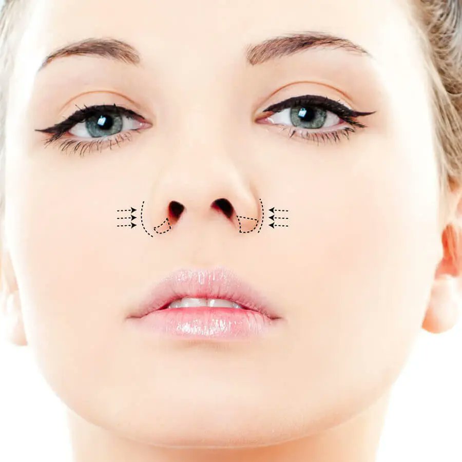 EnhanceClinicBe's tweet photo. Can wide nostrils change without surgery? Learn what Botox may change, what it cannot, how long results last, and what Belgian patients should know.
Read More: https://t.co/Jm9IRDKt8z
#neusvleugels https://t.co/fOghT9dxoD