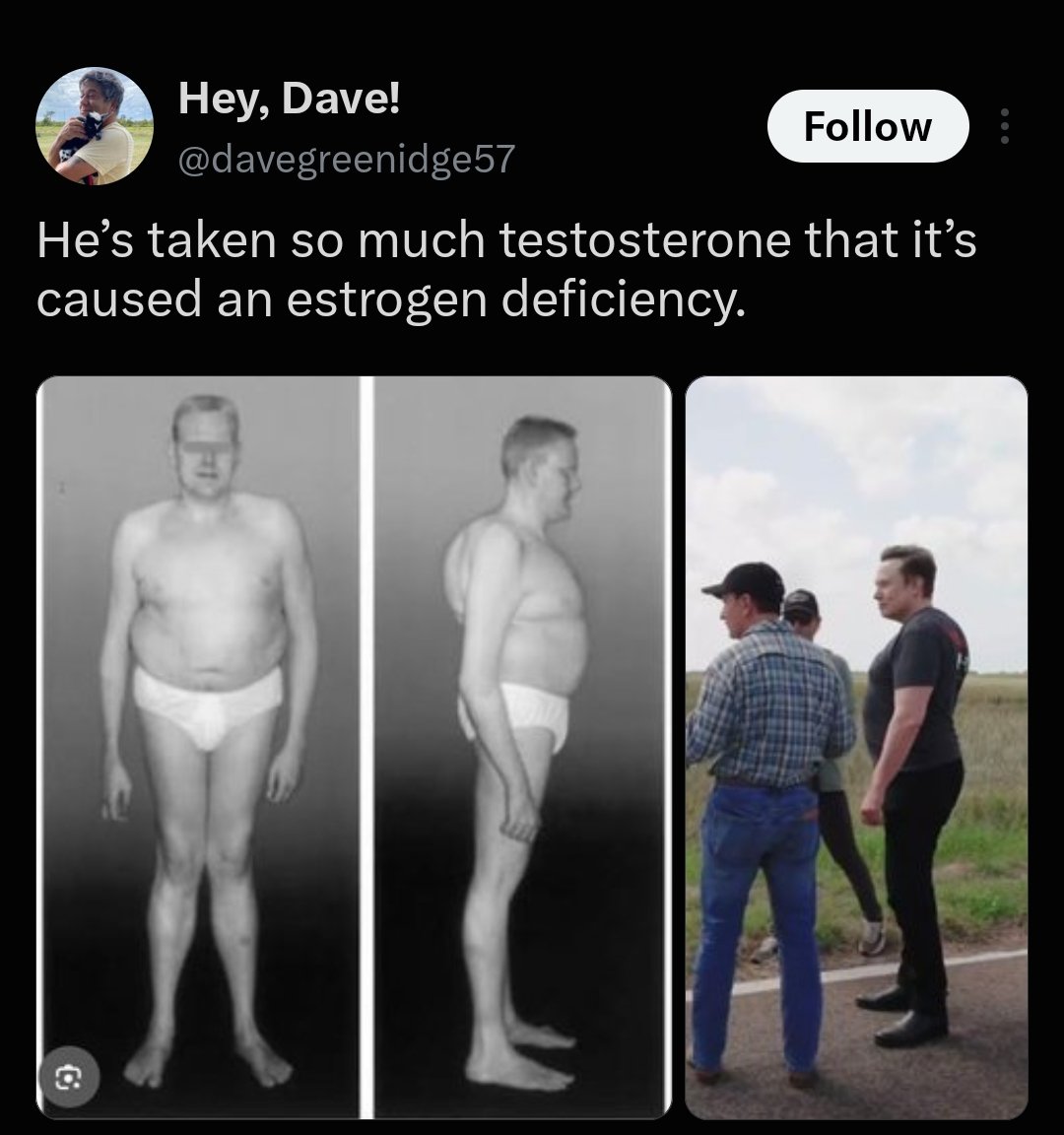 ZyvenVanta's tweet photo. A tweep claiming that Elon Musk's  barrel physique is caused by estrogen deficiency!!

Hey @grok, why does Elon Musk, have this body shape? What’s the science behind the “barrel chest” look? https://t.co/LArD3xV7uj