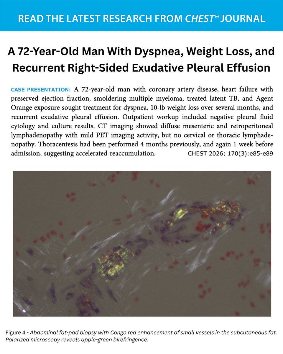 accpchest's tweet photo. A 72-Year-Old Man With Dyspnea, Weight Loss, and Recurrent Right-Sided Exudative Pleural Effusion
What's the diagnosis? Read the full CHEST Pearl in the September issue of the journal CHEST®: https://t.co/X6CHZG5kPK
#MedEd #JournalCHEST https://t.co/mfc23Ef4BH