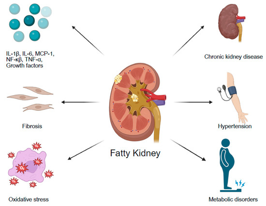 JCM_MDPI's tweet photo. #mdpijcm
📖 Recommended Read: #SystematicReview
#RenalFatAccumulation Assessed by #MRI or #CT and Its Association with Clinical and Metabolic Disorders
🎯https://t.co/NLR0c3EuHR
by Hadar Raphael et al.
@MediPharma_MDPI
#obesity #kidneydysfunction https://t.co/0w2fLHv8iz