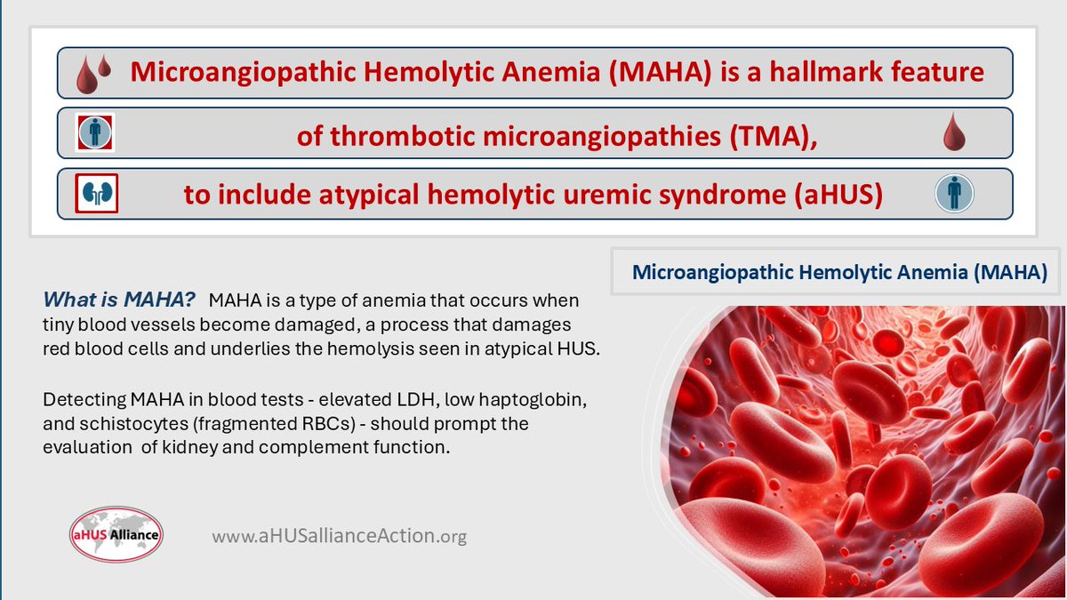 aHUSAllianceAct's tweet photo. Don't just look at your lab reports—understand them. What's #MAHA mean re #aHUS & other #TMA s? 3 major labs:
• High #LDH (cell damage/#clots)
• Low #Haptoglobin (active destruction: #RBC s)
• #Schistocytes (shredded cells)
Patients: ask your care team about these numbers📊 https://t.co/JriIYjnP2i