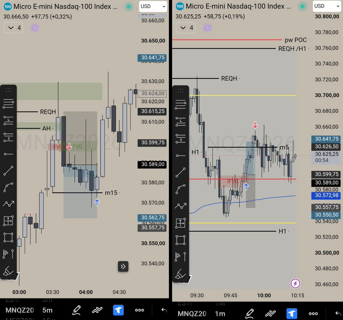 ZaruTrades's tweet photo. NASDAQ London + NY Session 🟢

London: 5m setup, moved my stop to breakeven, got taken out. No loss.

NY AM: 1m IFVG entry, waited a little bit after the open, played out clean.

1 BE, 1 W. Done for today. 🔥 https://t.co/fvGTojVrm2
