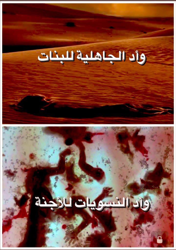 hashemuf1's tweet photo. تقتل النسويات 
سنوياً 73 مليون طفل وجنين كل عام 
هذه الأرقام صادرة من منظمة الصحة العالمية
وهذه إبادة أعظم من الحروب العالمية
وأخطر من الأسلحة النووية 

كل هذا بسبب الزنا و الإباحية https://t.co/yAmDwAVIQD