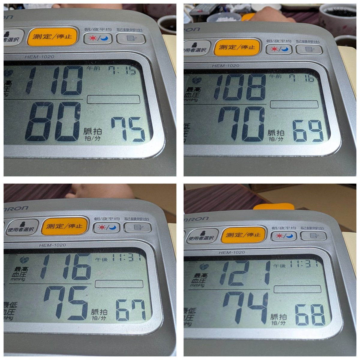 tomotamachiko's tweet photo. 2026/09/29(火)⁡
⁡お仕事🏥💊➜お休み⁡
⁡母の病院🏥🏃💦受診日⁡
⁡後は、なーんもしなかった😭⁡
⁡そして、1日☔だった。⁡
⁡...(lll-ω-)ﾁｰﾝ⁡
⁡(*˘︶˘*)ｵﾔｽﾐﾅｻｲ~..♡ https://t.co/a3knDkyeY9