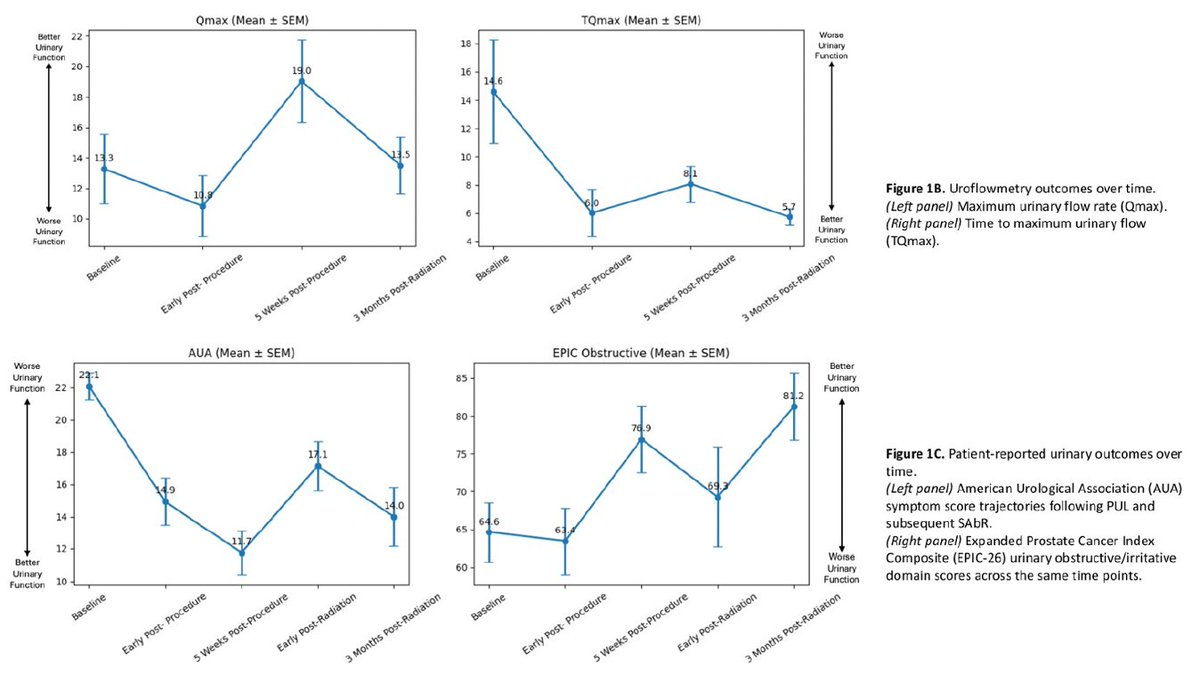RKSayyid's tweet photo. UroLift pre-SAbR (40 Gy in 5 fx) for PCa men w/ symptomatic BPH: updated phase I results (n=15)
🔹UroLift + spacer procedures: 100% technically successful; no intraoperative complications
 🔹Acute toxicity limited to grade 1–2 GU events; no grade ≥3 toxicity or hospital admissions (median f/u: 15 mo)
 🔹AUASS improved from 22.1 at baseline → 13.6 at 6 mo → 14.1 at 15 mo (p<0.001)
 🔹EPIC-26 urinary obstructive/irritative score improved to 81.2 at 3 mo post-SAbR
📌UroLift pre-SAbR may provide durable LUTS improvement w/ a favorable safety profile  Potentially broadening eligibility for ultrahypofractionated RT in men with concomitant BPH
@urotoday #ASTRO26