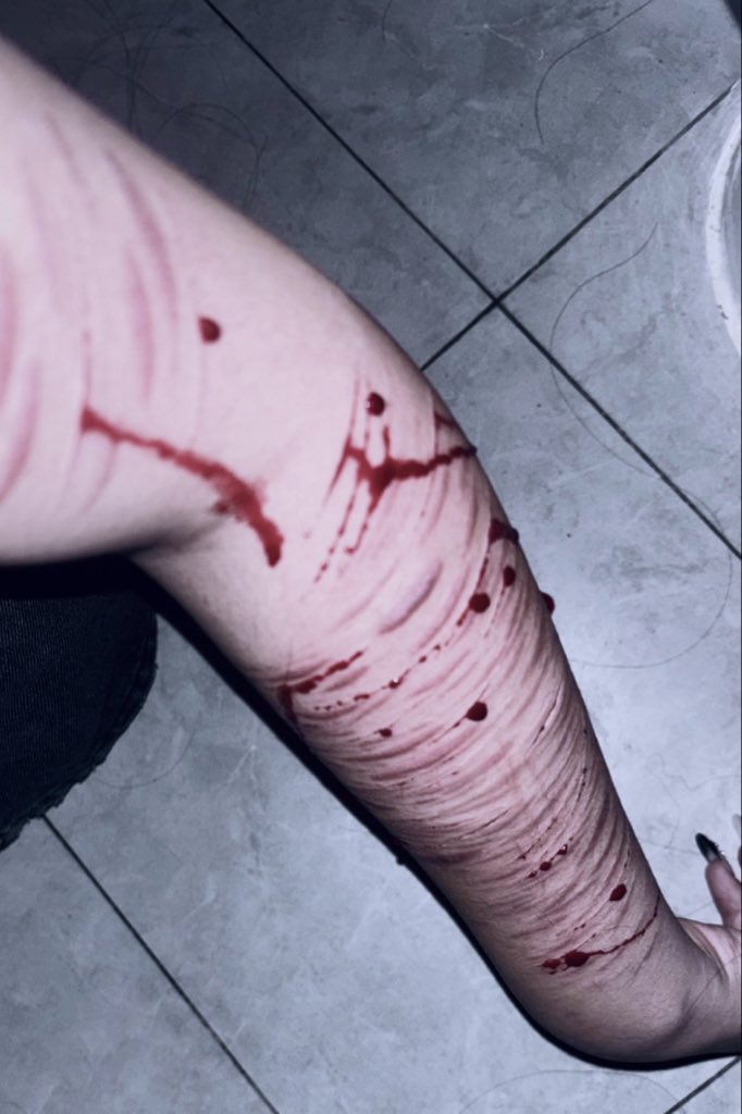 Vchan1archived's tweet photo. Fake blood, sensitive content, no other implications 
#scarspo https://t.co/SQ0Jufm6vr