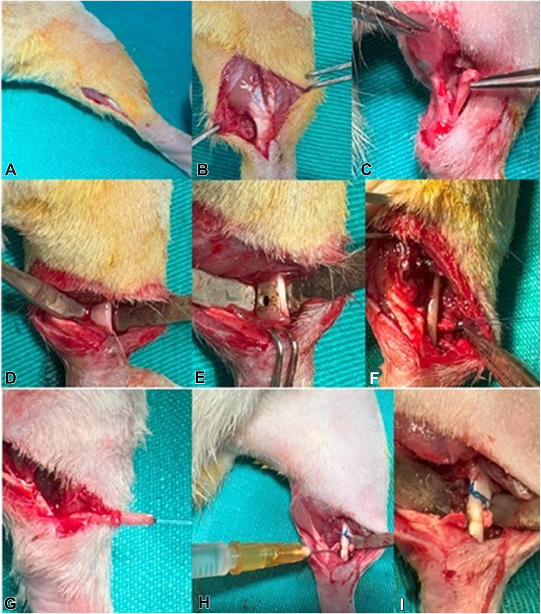 JHandSurg's tweet photo. Can we improve tendon-to-bone healing with a cell-free regenerative strategy? A new rat study evaluated mesenchymal stem cell–derived #exosomes combined with a 3D hyaluronan-based scaffold for tendon-to-bone healing. Read more: https://t.co/v3p5ykH3O5
#JHS #RegenerativeMedicine https://t.co/gEBfGPkStV