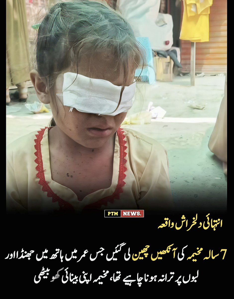 Asmatcomrade's tweet photo. زړه بوږنوونکې خبر 💔

د مرکزي کرم د زویمشت خټک مېلې اړوند یوه ۷ کلنه معصومه ماشومه د «وحشي پنجابي استعماري پوځ» د هاوان مرمۍ ښکار شوې او له بده مرغه یې د خپلو دواړو سترګو بینايي له لاسه ورکړې ده.

سبا دې ریاست دا تمه نه لري چې د دې معصومې ماشومې په لاس کې ولې بیرغ نشته؟

1/1 https://t.co/gCbvejVbgm
