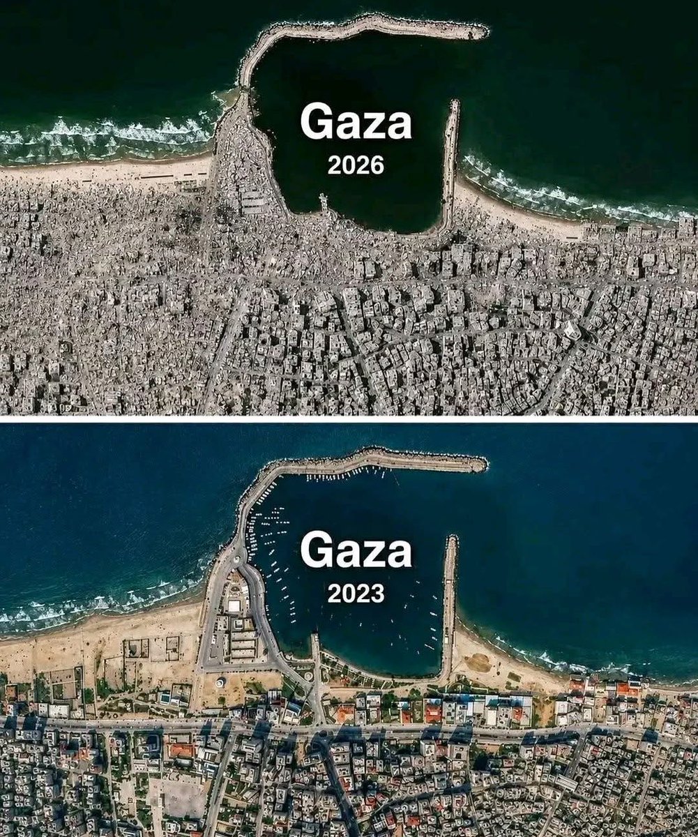 mazedar_Tweets's tweet photo. Before &amp; After 💔😫 https://t.co/jhjoJXvgJd