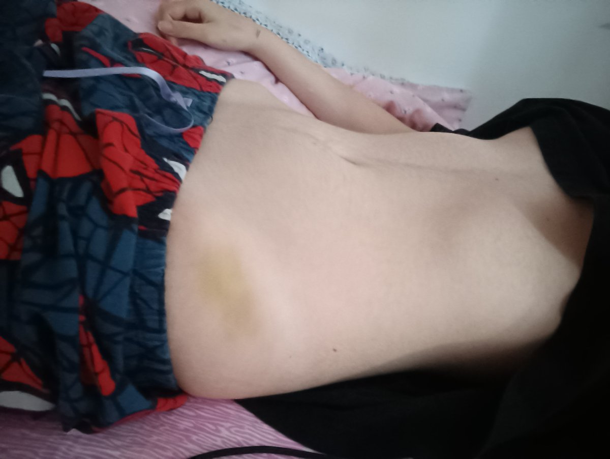 shepyPJigoku's tweet photo. One week difference each i don't even know how much i weigh I don't give a gaf im fat looking like this even if i was 1.2kg https://t.co/luqYQix8Sg