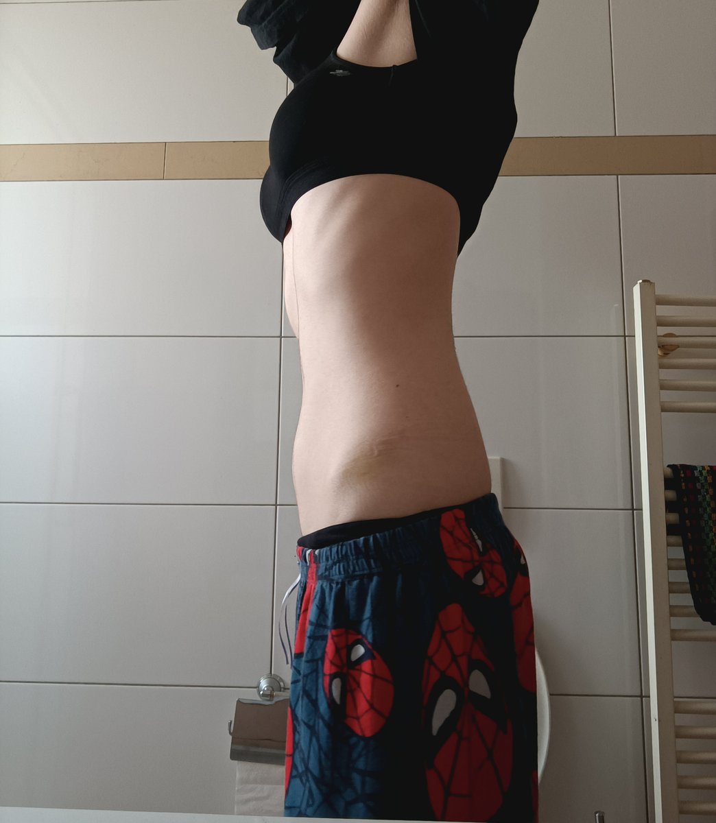 shepyPJigoku's tweet photo. One week difference each i don't even know how much i weigh I don't give a gaf im fat looking like this even if i was 1.2kg https://t.co/luqYQix8Sg