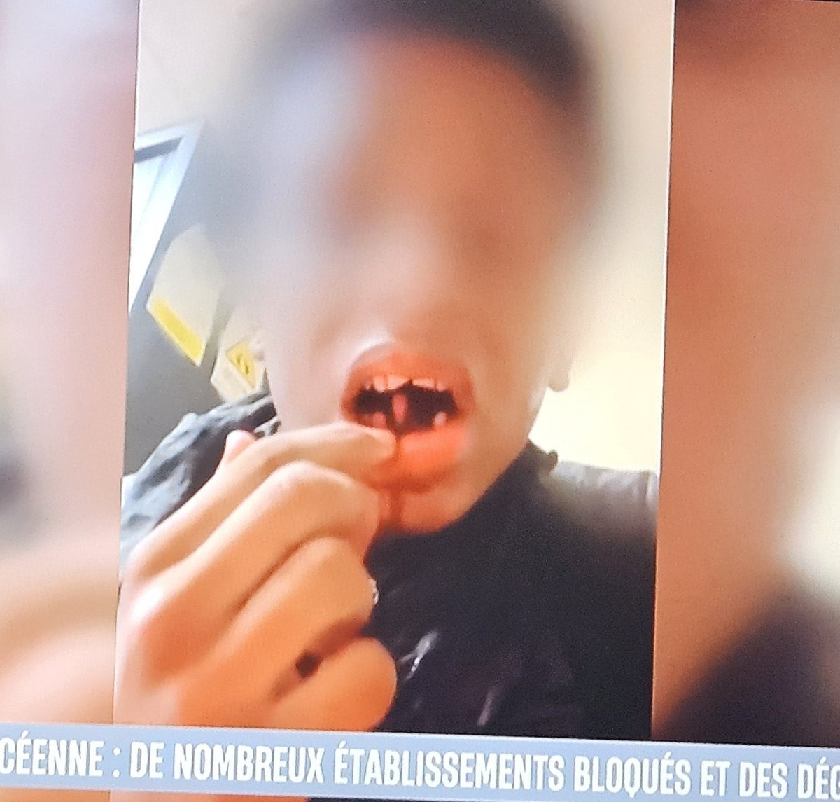 Lerateldu77's tweet photo. Wallah j'ai plus de dents 🤣🤣 https://t.co/arnEkiKrUD