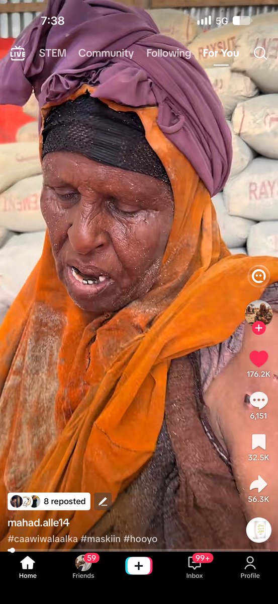 mohhagio's tweet photo. 🚨 APPEAL FOR HELP | 70-YEAR-OLD MOTHER IN NEED OF SUPPORT

Please share this video so her story can reach anyone who is able to help.

This is a 70-year-old mother who is still working at a construction site because she does not have a son or anyone to stand by her and help her with the difficult work and challenges of daily life. She is also suffering from illness and hardship, yet her difficult circumstances continue to force her to work.

We are appealing to the Somali community and anyone who is able to support her: please stand with this mother. Whatever you can provide financial assistance, food, medicine, or any other form of support—could make a meaningful difference in her life.

The mother’s phone number It is provided in the later part of the video.

Please share this video so the message can reach someone who is able to help.

A mother is a mother. Today, she needs our support. ❤️🤲