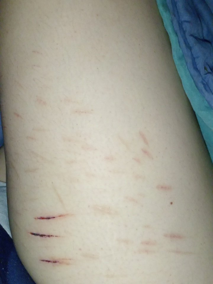 Maynac3dt's tweet photo. Old scars

SFX MAKEUP
AI
AI MADE
NEW PROP FOR A HORROR MOVIE https://t.co/CWDcQIKDum