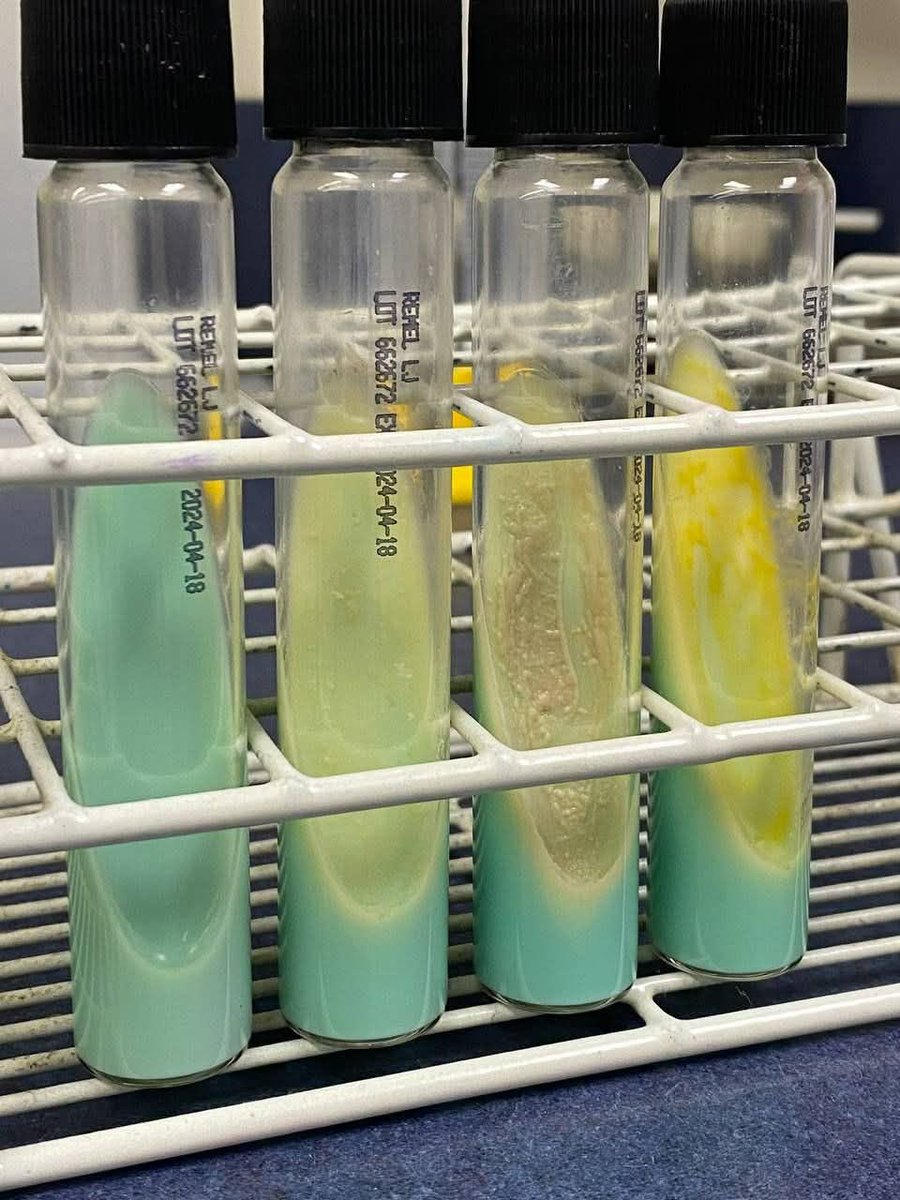 laboratorykh's tweet photo. سؤال اليوم 🔬🎯

ما اسم هذا الوسط الزراعي؟
ولاي نوع من البكتيريا يستخدم؟🦠
#مختبرات_طبيه
#microbiology https://t.co/PGeThUmN5A