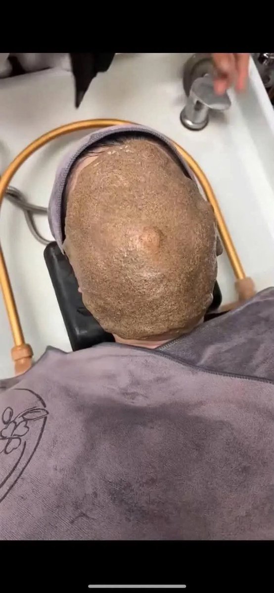 auroralun_a's tweet photo. Susah payah ngerayu suami biar diizinin spa sendirian, eh malah kebagian terapis baru 😭
Maskernya dipasang tanpa lubang buat napas. Lima menit doang aku udah panik, akhirnya tarik sendiri maskernya.
Terapisnya malah kesel, katanya emang gitu prosedurnya 😭 https://t.co/BINka1TXeG