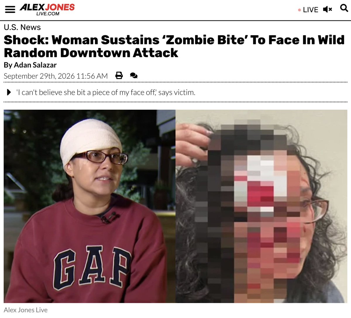 Random Attack Network Shock: Woman Sustains ‘Zombie Bite’ To Face In Wild Random Downtown ...