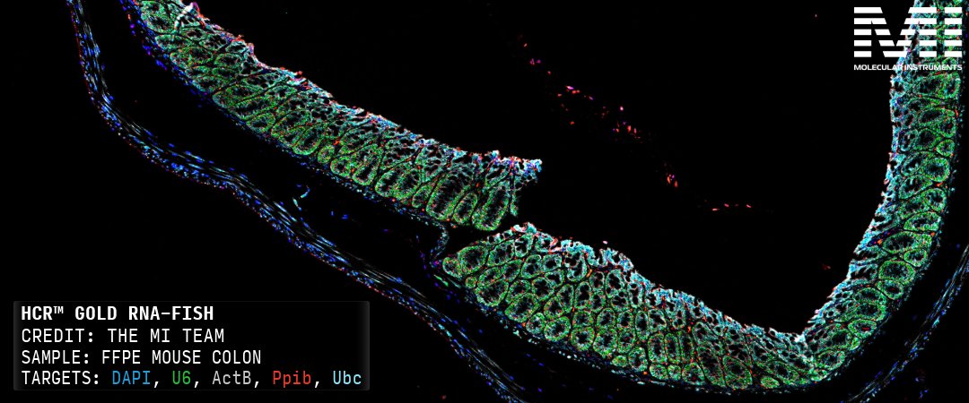 HCRimaging's tweet photo. More fluorophore options, more ways to build your HCR™ Gold assay.

HCR™ Gold Amplifiers are now available with 488, 546, 594, and 647 labels across every X system, giving you more flexibility when designing panels around your targets and imaging channels.

Ready to explore the new options? Shop the expanded amplifier selection today.

🛒 https://t.co/Fn21gj66u3