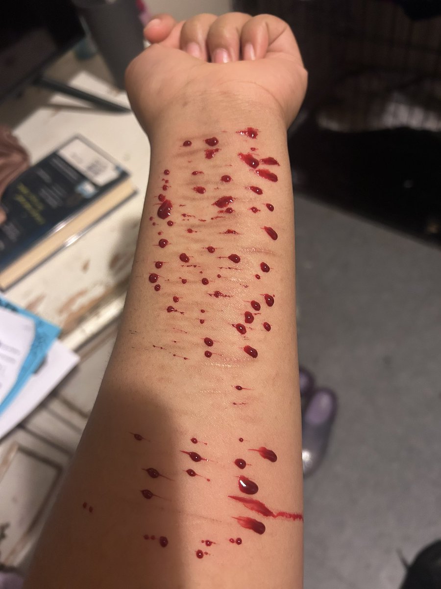 lexxi_blahh's tweet photo. Did some fake wound makeup 🤗 #sfxmakeup #fakeblood #slittwt #shtwt #relapsetwt #988twt https://t.co/xAu63qZpbM