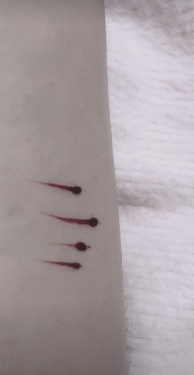 vanilescenq's tweet photo. ︵︵︵ ๑ ♡ ๑ ︵︵︵
teeny styros b4 bed <3
            #slittwt 

all fake fake blade fake blood fake scars not real!! only halloween sfx https://t.co/thsfYoXpOK