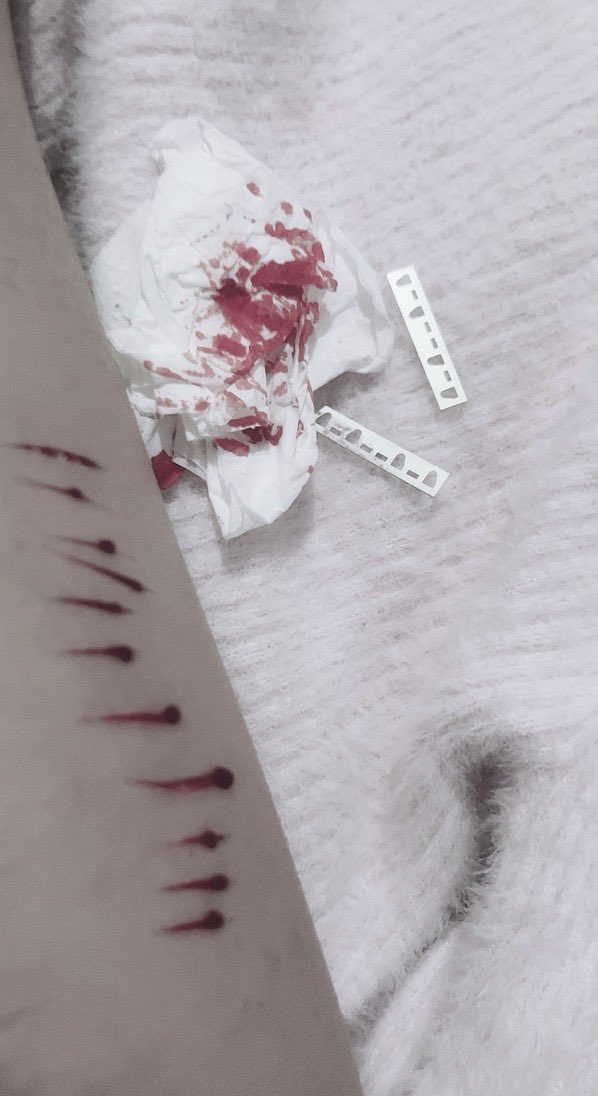 vanilescenq's tweet photo. ︵︵︵ ๑ ♡ ๑ ︵︵︵
teeny styros b4 bed <3
            #slittwt 

all fake fake blade fake blood fake scars not real!! only halloween sfx https://t.co/thsfYoXpOK