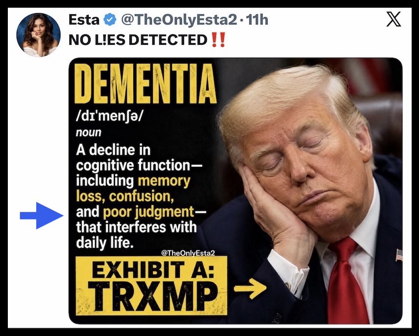 kangaroos991's tweet photo. OMG, #DementiaDon is asleep AGAIN!
Sadly, there's no way to 'sugarcoat' his
obvious 'decline' in #cognitive capacity
including: loss of #memory, confusion
and especially POOR 'decision' making,
like #DumbTariffs & #EndlessWAR! 😡
Agree? 🙋♀️
👇Cr: @TheOnlyEsta2 👍 #VoteBlue 💙 https://t.co/bvlLLfHHOR