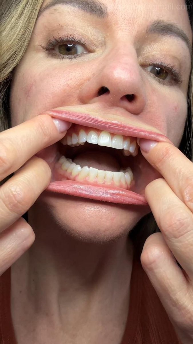 mzcorysplaytime's tweet photo. MzCory whitens her teeth &amp; stretches her mouth wide with a cheek spreader 👅 close-ups, tongue on lips, raspberry sounds &amp; more #mouthfetish #dentalfetish #cheekspreader #mzcory #fetishcontent #oralplay #adultcontent #lipplay https://t.co/wGDZJypBuV https://t.co/orTbjYKeVz