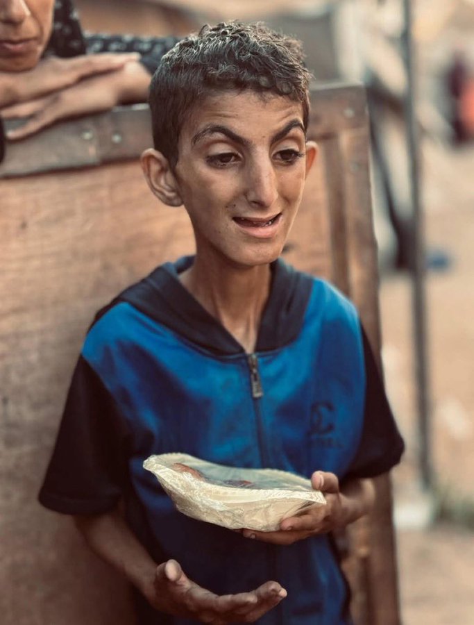 IbrahimHuda12's tweet photo. الجوع كافر!

معاناة اطفال فلسطين بلا حدود 

تحدّثوا عن الجوع… 

قبل أن يموت أطفال غزة من الجوع جميعا....

لا تتوقفوا عن نشر جرائم الاحتلال.. https://t.co/l4i5Kdl8qw