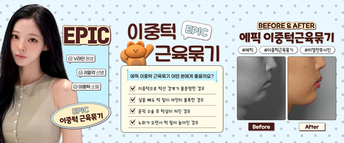 epic_plastic's tweet photo. ⠀
➔ 에픽 이중턱 근육묶기🤎
⠀
이중턱의 근본적인 문제를 해결하여
자연스러운 V라인 턱선으로 개선합니다.
⠀
쏙 들어간 라인을 만드는
에픽의 기술력을 확인하세요!
.
.
#에픽성형외과 #에픽 #노용준원장 #홍진명원장 #이중턱 #이중턱근육묶기 #이중턱근육묶기후기 #이중턱수술 #근육묶기 https://t.co/ida4h9zPTD